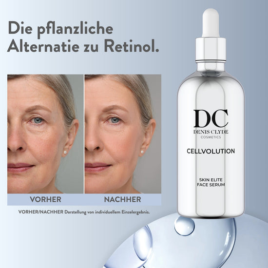 Vorher-Nachher-Vergleich zum Face Serum, individuelles Einzelergebnis