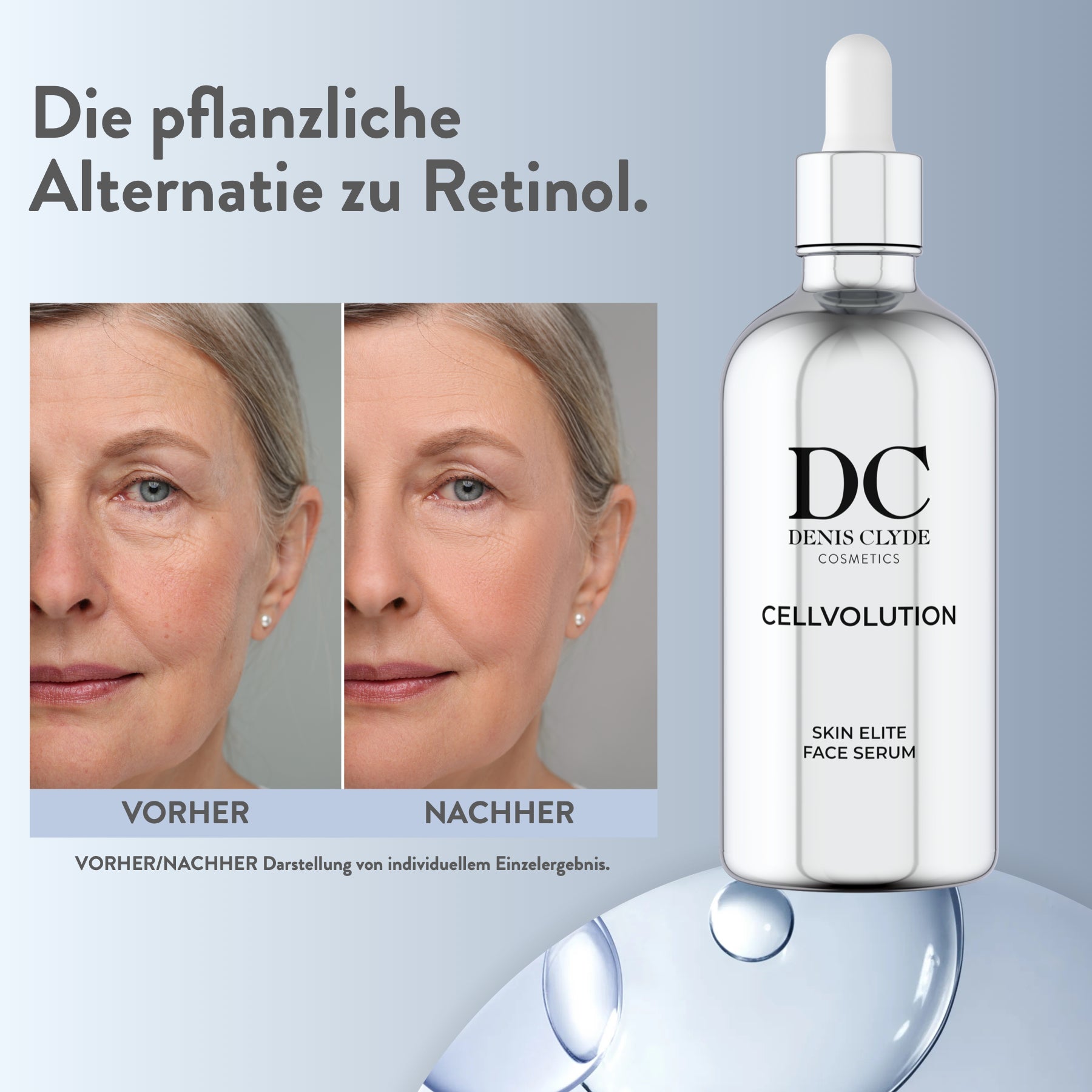 Vorher-Nachher-Vergleich zum Face Serum, individuelles Einzelergebnis