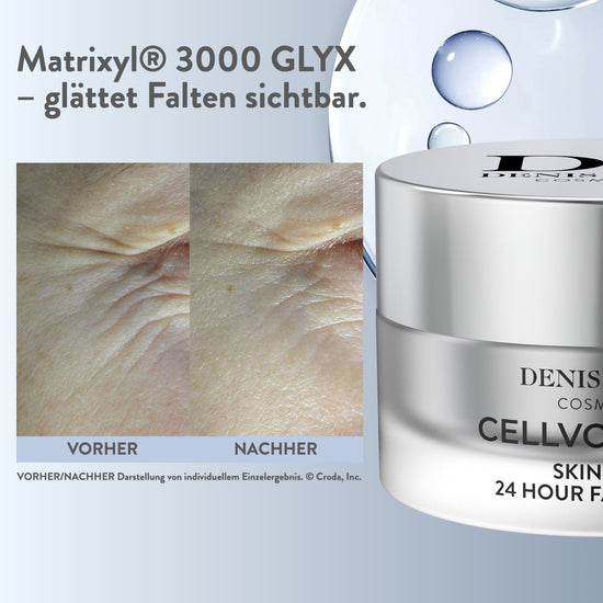 Vorher-Nachher-Vergleich zur 24 Hour Face Cream, individuelles Einzelergebnis