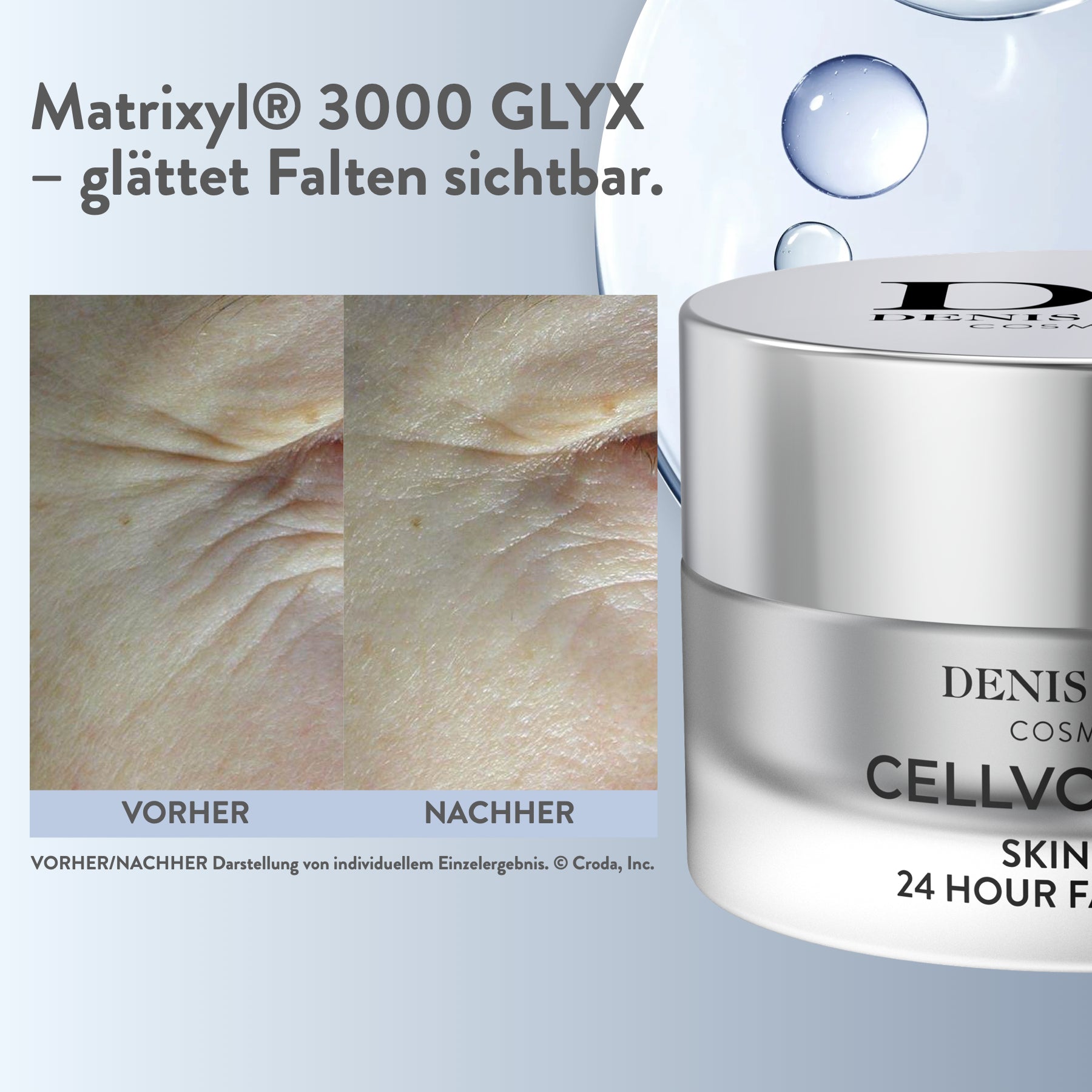 Vorher-Nachher-Vergleich zur 24 Hour Face Cream, individuelles Einzelergebnis