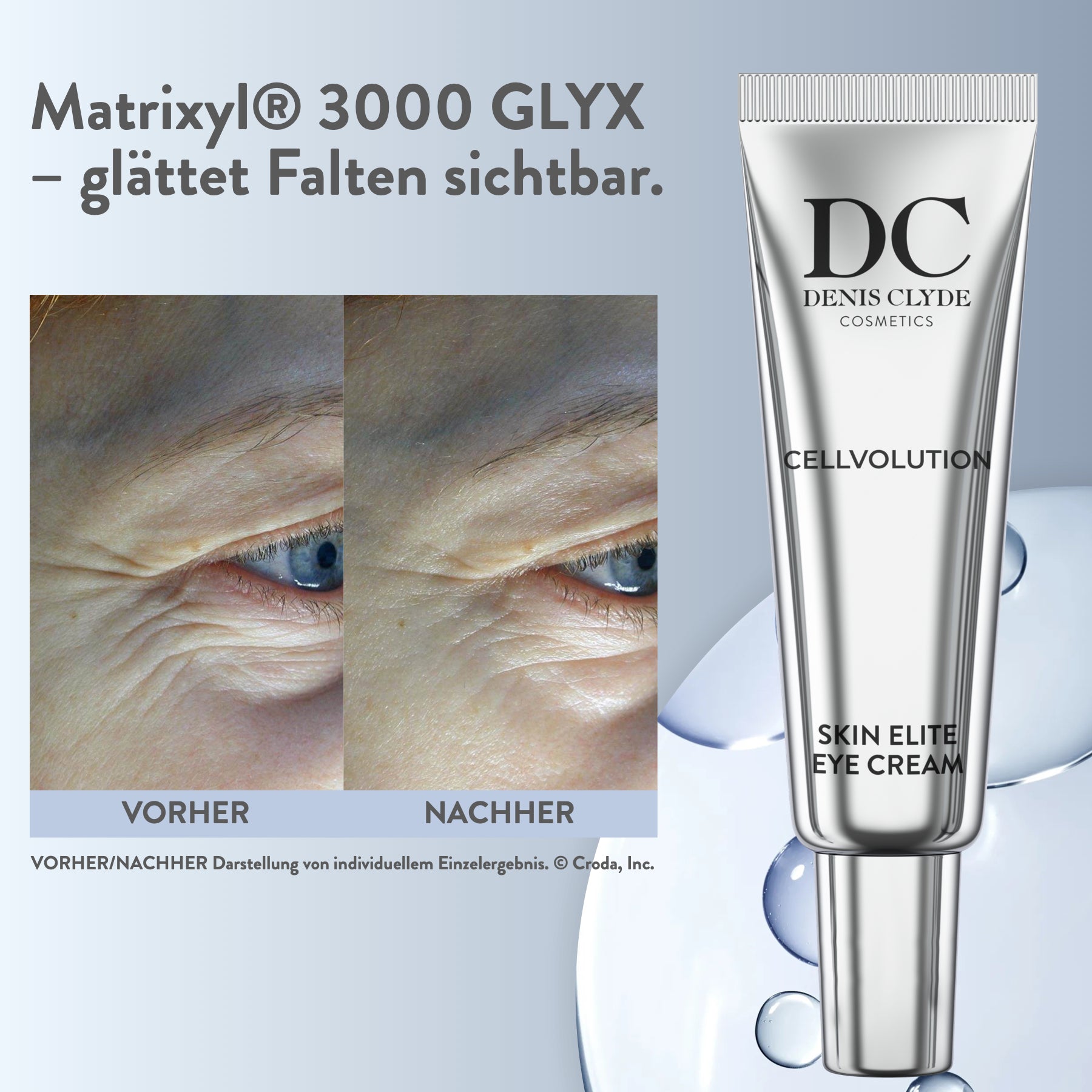 Vorher-Nachher-Vergleich zur Eye Cream, individuelles Einzelergebnis
